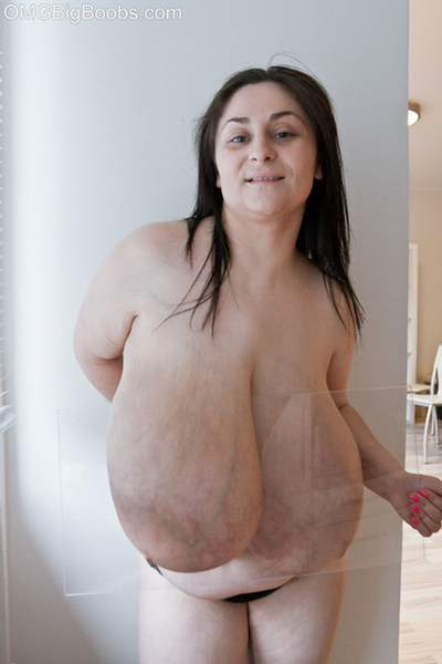 Massive Macromastia Boobs - Gigantomastia Breasts | Sex Pictures Pass