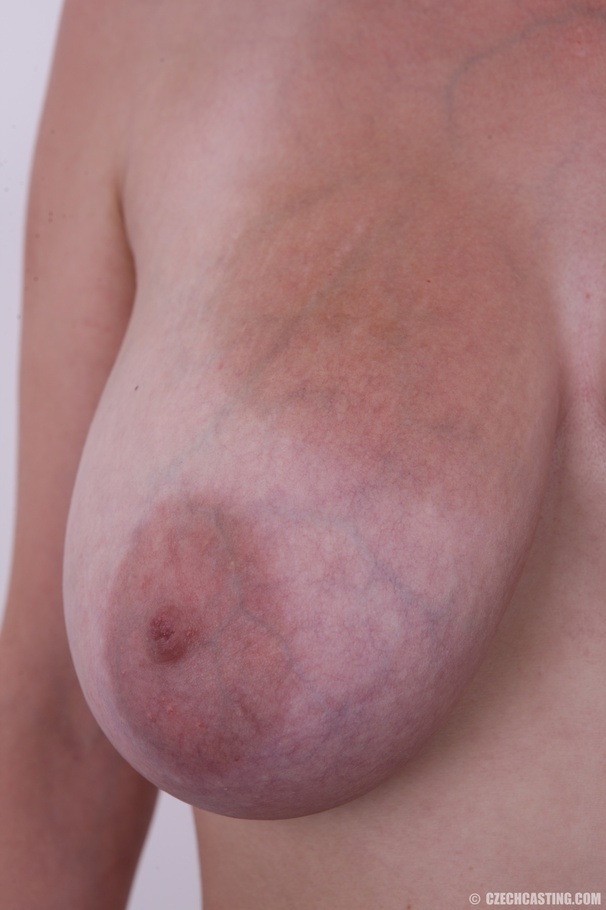 Youngster with freckles and big tits happil - XXX Dessert - Picture 12