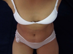 Xxx homemade pics of amateur indian girl posing in white tight undies. - Picture 1