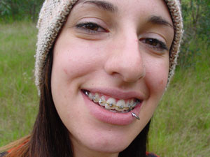 Long-haired brunette girl with braces and a hat shot herself outdoors - XXXonXXX - Pic 1