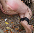Bound teen getting her pooper inflates with red syrup