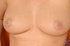 bras barb