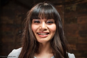 An Asian with braces on her teeth feels  - Picture 1