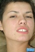 Short haired harlot with pierced belly took off white thongs and masturbating